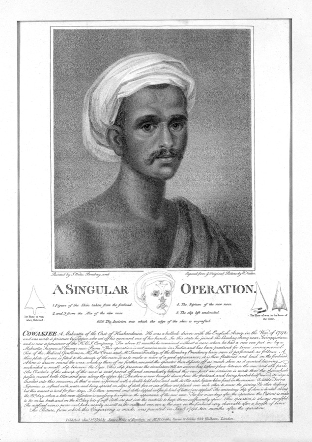 1794 engraving published in The Gentleman's Magazine showing Cowasjee's portrait and the diagram of the forehead-flap rhinoplasty